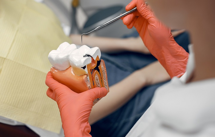 root canal treatment cost 
