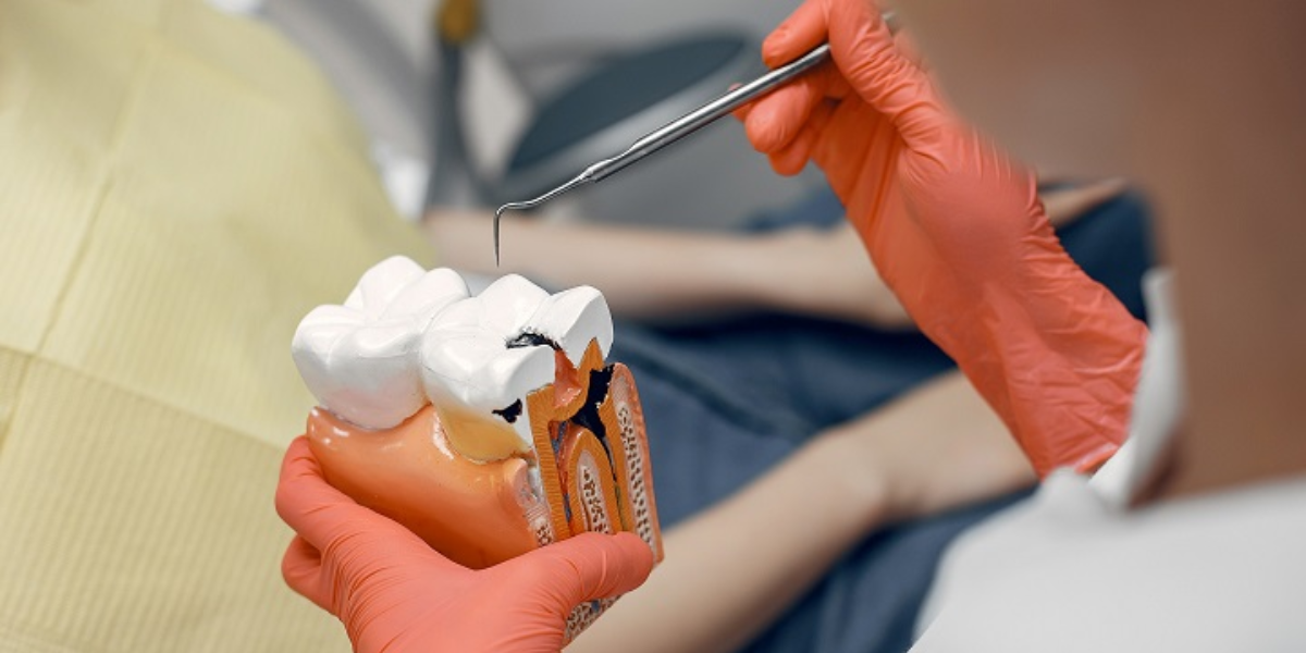 root canal treatment cost 
